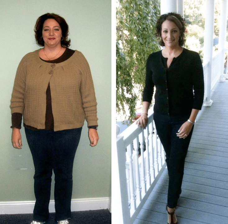 Experience using Reduslim, before and after photos